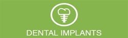 Implantes Dentales