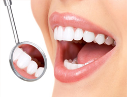 Estética Dental