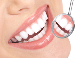 Estética Dental